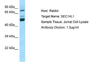 Western Blotting (WB) image for anti-SEC14-Like 1 (SEC14L1) (N-Term) antibody (ABIN2790166) (SEC14L1 Antikörper  (N-Term))