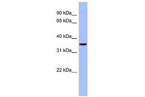 PPM1A antibody used at 1 ug/ml to detect target protein. (PPM1A Antikörper)