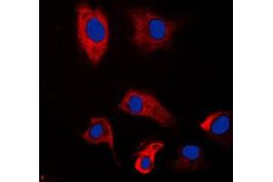 Immunofluorescent analysis of PSMD2 staining in HeLa cells.