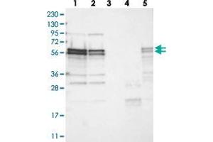 Western blot analysis of Lane 1: RT-4, Lane 2: U-251 MG, Lane 3: Human Plasma, Lane 4: Liver, Lane 5: Tonsil with ZC3H15 polyclonal antibody  at 1:250-1:500 dilution. (ZC3H15 Antikörper)