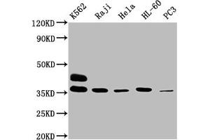Western Blot Positive WB detected in: K562 whole cell lysate, Raji whole cell lysate, Hela whole cell lysate, HL60 whole cell lysate, PC-3 whole cell lysate All lanes: FCGR2A antibody at 1:2000 Secondary Goat polyclonal to rabbit IgG at 1/50000 dilution Predicted band size: 36, 35 kDa Observed band size: 36 kDa (FCGR2A Antikörper  (AA 241-317))