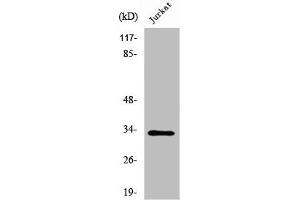 Western Blot analysis of Jurkat cells using UCP3 Polyclonal Antibody (UCP3 Antikörper  (C-Term))