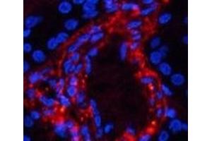 Immunofluorescence analysis of Human kidney tissue using Phospho-Catenin beta (Ser37) Polyclonal Antibody at dilution of 1:200 (beta Catenin Antikörper  (pSer37))