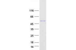 Western Blotting (WB) image for G Kinase Anchoring Protein 1 (GKAP1) (Transcript Variant 1) protein (Myc-DYKDDDDK Tag) (ABIN2721893)