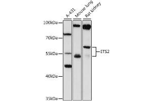 Western blot analysis of extracts of various cell lines, using ETS2 antibody (ABIN4903614) at 1:1000 dilution. (ETS2 Antikörper)
