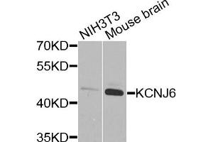 Western blot analysis of extracts of NIH3T3 and mouse brain cells, using KCNJ6 antibody. (KCNJ6 Antikörper)
