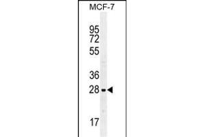 LGALS3 Antibody (C-term) (ABIN655879 and ABIN2845280) western blot analysis in MCF-7 cell line lysates (35 μg/lane). (Galectin 3 Antikörper  (C-Term))