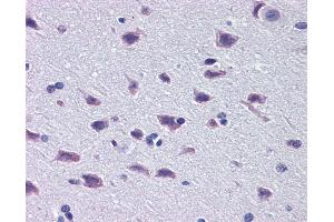 Immunohistochemistry (IHC) image for anti-Diencephalon/mesencephalon Homeobox 1 (DMBX1) (Middle Region) antibody (ABIN183501) (DMBX1 Antikörper  (Middle Region))