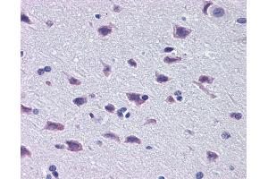 Immunohistochemistry (IHC) image for anti-Diencephalon/mesencephalon Homeobox 1 (DMBX1) (Middle Region) antibody (ABIN2780096) (DMBX1 Antikörper  (Middle Region))