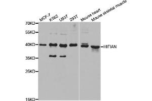Western blot analysis of extracts of various cell lines, using HIF1AN antibody (ABIN5973179) at 1/1000 dilution. (HIF1AN Antikörper)