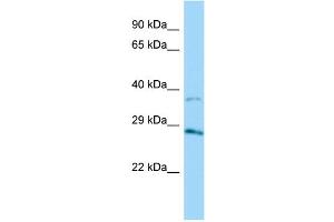 Host: Rabbit Target Name: AKR1B15 Sample Type: HT1080 Whole Cell lysates Antibody Dilution: 1. (AKR1B15 Antikörper  (C-Term))