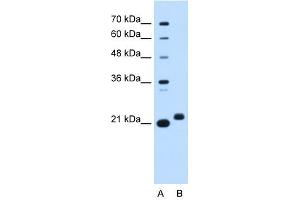 C1ORF159 antibody used at 0. (C1orf159 Antikörper  (Middle Region))