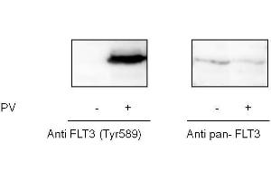 A431 cells were treated or untreated with Pervanadate. (FLT3 ELISA Kit)