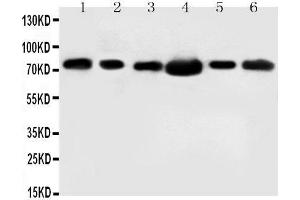 Anti-FAF1 antibody, Western blotting Lane 1: Rat Testis Tissue Lysate Lane 2: MM453 Cell Lysate Lane 3: MM231 Cell Lysate Lane 4: HELA Cell Lysate Lane 5: SMMC Cell Lysate Lane 6: SW620 Cell Lysate (FAF1 Antikörper  (N-Term))