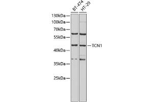 Western blot analysis of extracts of various cell lines, using TCN1 antibody (ABIN6132752, ABIN6148950, ABIN6148951 and ABIN6222050) at 1:1000 dilution. (TCN1 Antikörper  (AA 24-280))