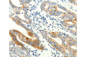 Immunohistochemistry (IHC) image for anti-Transient Receptor Potential Cation Channel, Subfamily A, Member 1 (TRPA1) antibody (ABIN2432369) (TRPA1 Antikörper)