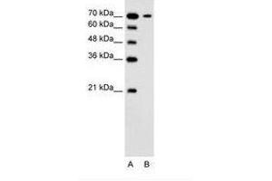 Image no. 1 for anti-Solute Carrier Family 5 (Low Affinity Glucose Cotransporter), Member 4 (SLC5A4) (N-Term) antibody (ABIN205017) (SLC5A4 Antikörper  (N-Term))