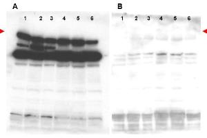 Image no. 2 for anti-Pogo Transposable Element with ZNF Domain (POGZ) (N-Term) antibody (ABIN401435) (POGZ Antikörper  (N-Term))