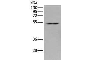 Western blot analysis of HEPG2 cell lysate using ZNF672 Polyclonal Antibody at dilution of 1:350 (ZNF672 Antikörper)