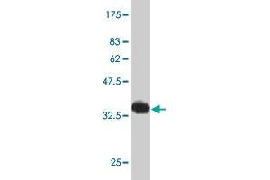Western Blot detection against Immunogen (34. (HAND2 Antikörper  (AA 135-216))