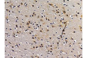 ABIN7094290 and ABIN7098337 at 1/100 staining mouse brain tissue by IHC-P.