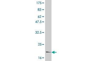 Western Blot detection against Immunogen (21 KDa) .