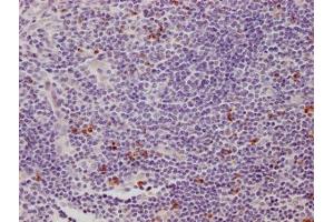 Immunohistochemistry (IHC) image for anti-Lymphocyte-Activation Gene 3 (LAG3) (AA 29-450) antibody (ABIN7158617)