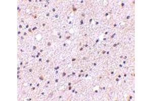 Immunohistochemical staining of human brain tissue with 5 ug/mL CADPS polyclonal antibody . (CADPS Antikörper  (N-Term))