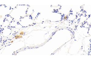Detection of MMP12 in Rat Lung Tissue using Polyclonal Antibody to Matrix Metalloproteinase 12 (MMP12) (MMP12 Antikörper  (AA 372-463))