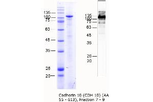Western Blotting (WB) image for Cadherin 10, Type 2 (T2-Cadherin) (CDH10) (AA 55-613) protein (MBP tag) (ABIN3098176) (CDH10 Protein (AA 55-613) (MBP tag))