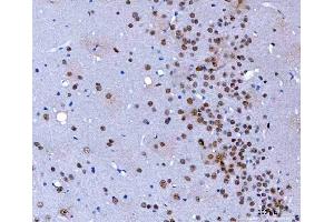 IHC analysis of HnRNP H/HNRNPH1 using anti-HnRNP H/HNRNPH1 antibody (ABIN4886623).