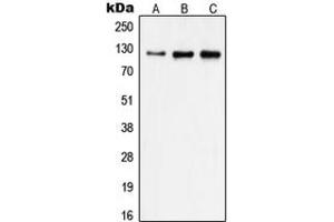 Western blot analysis of Focal Adhesion Kinase expression in A431 (A), HeLa (B), MDAMB231 (C) whole cell lysates. (FAK Antikörper  (Center))