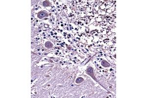 NC Antibody (C-term) ((ABIN657952 and ABIN2846897))immunohistochemistry analysis in formalin fixed and paraffin embedded human cerebellum tissue followed by peroxidase conjugation of the secondary antibody and DAB staining. (NPPC Antikörper  (C-Term))