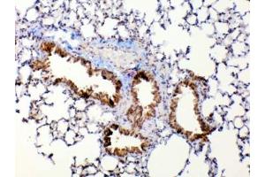 IHC testing of FFPE mouse lung tissue with Mmp13 antibody at 1ug/ml. (MMP13 Antikörper)