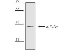 Western Blotting (WB) image for anti-Eukaryotic Translation Initiation Factor 2A, 65kDa (EIF2A) antibody (ABIN7211398) (EIF2A Antikörper)