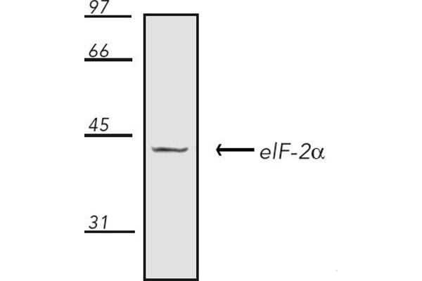 EIF2A antibody
