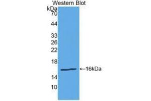 Western blot analysis of the recombinant protein. (Renin Antikörper  (AA 67-179))