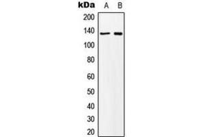 Western blot analysis of MN1 expression in K562 (A), NIH3T3 (B) whole cell lysates.