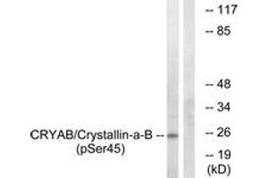 Western blot analysis of extracts from COS7 cells treated with anisomycin 25ug/ml 30', using CRYAB (Phospho-Ser45) Antibody. (CRYAB Antikörper  (pSer45))