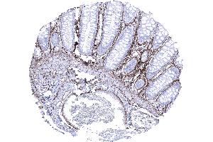 Colon descendes mucosa Elastin fibres predominate in the lamina propria around smooth muscle cells of the muscularis mucosae and in blood vessels (Rekombinanter Elastin Antikörper)