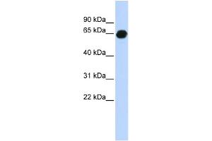 WB Suggested Anti-B3GALNT2 Antibody Titration:  0.