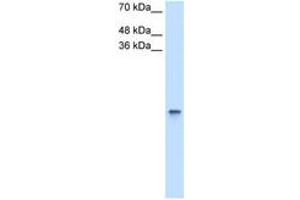 Image no. 1 for anti-Retinol Binding Protein 1, Cellular (RBP1) (AA 113-162) antibody (ABIN204984)