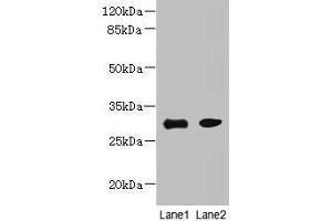 Western blot All lanes: PI4KAP1 antibody at 10 μg/mL Lane 1: Mouse gonadal tissue Lane 2: 293T whole cell lysate Secondary Goat polyclonal to rabbit IgG at 1/10000 dilution Predicted band size: 30 kDa Observed band size: 30 kDa (PI4KAP1 Antikörper  (AA 1-262))