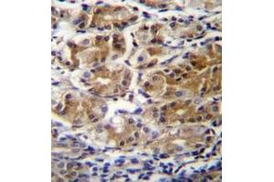 Immunohistochemistry analysis in formalin fixed and paraffin embedded human stomach tissue reacted with PDPR Antibody (C-term) followed by peroxidase conjugation of the secondary antibody and DAB staining. (PDPR Antikörper  (C-Term))