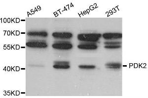 Western Blotting (WB) image for anti-Pyruvate Dehydrogenase Kinase, Isozyme 2 (PDK2) (AA 128-407) antibody (ABIN6220461) (PDK2 Antikörper  (AA 128-407))