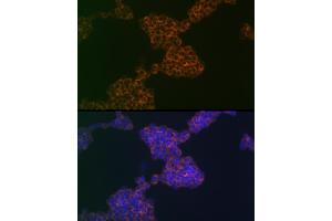 Immunofluorescence analysis of Jurkat cells using CD3G Rabbit mAb (ABIN1682574, ABIN3018517, ABIN3018518 and ABIN7101622) at dilution of 1:100 (40x lens). (CD3G Antikörper)