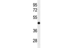 IRF2 antibody western blot analysis in mouse bladder tissue lysate (IRF2 Antikörper  (AA 225-255))