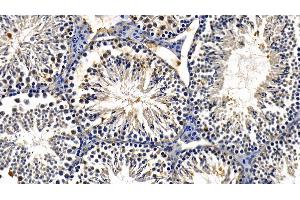 Detection of TBK1 in Mouse Testis Tissue using Polyclonal Antibody to TANK Binding Kinase 1 (TBK1) (TBK1 Antikörper  (AA 9-310))