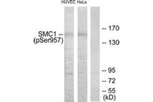 Western blot analysis of extracts from HuvEc cells treated with EGF 200ng/ml 5'/HeLa cells treated with EGF 200ng/ml 15', using SMC1 (Phospho-Ser957) Antibody. (SMC1A Antikörper  (pSer957))