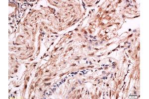 Formalin-fixed and paraffin embedded rat placenta labeled with Anti-FOXF1 Polyclonal Antibody, Unconjugated  at 1:200 followed by conjugation to the secondary antibody and DAB staining.